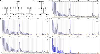 Multisystemic Impairments in 93 Chinese Patients With Myotonic Dystrophy Type 1